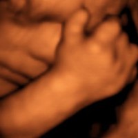Babycocoon3d-image-echographie-03
