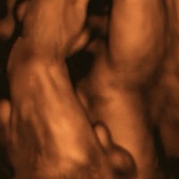 Babycocoon3d-image-echographie-04