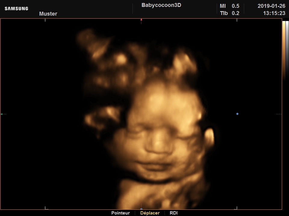 Babycocoon 3d Institut D Echographie 3d Prenatale A Nyon Babycocoon 3d Institut D Echographie 3d Prenatale A Nyon