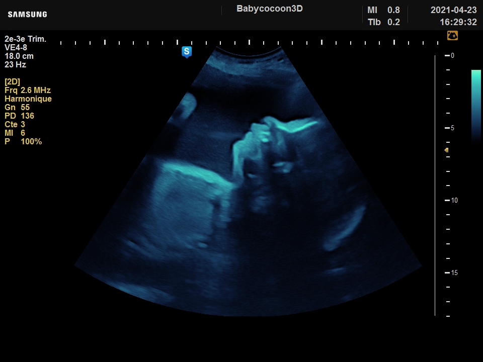 Cadre en bois pour maman enceinte pour femmes enceintes Cadre photo  sonogramme Cadre photo échographie pour bébé Idées cadeaux